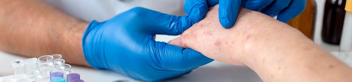 Melanoma cutâneo